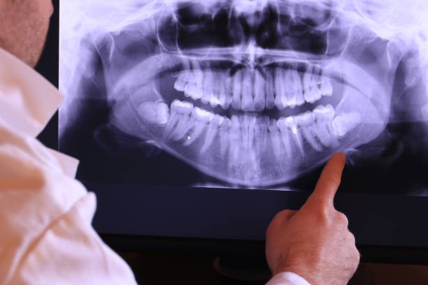 Best Chipped Tooth Repair Near Me  in Pymatuning Central, PA