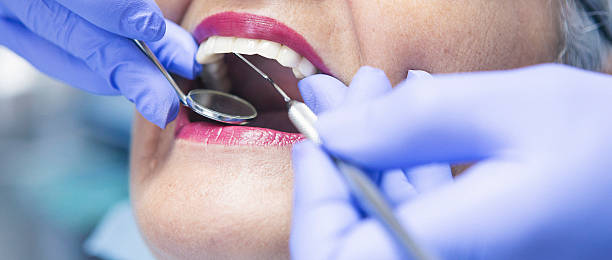 Best Knocked-Out Tooth Emergency  in Pymatuning Central, PA